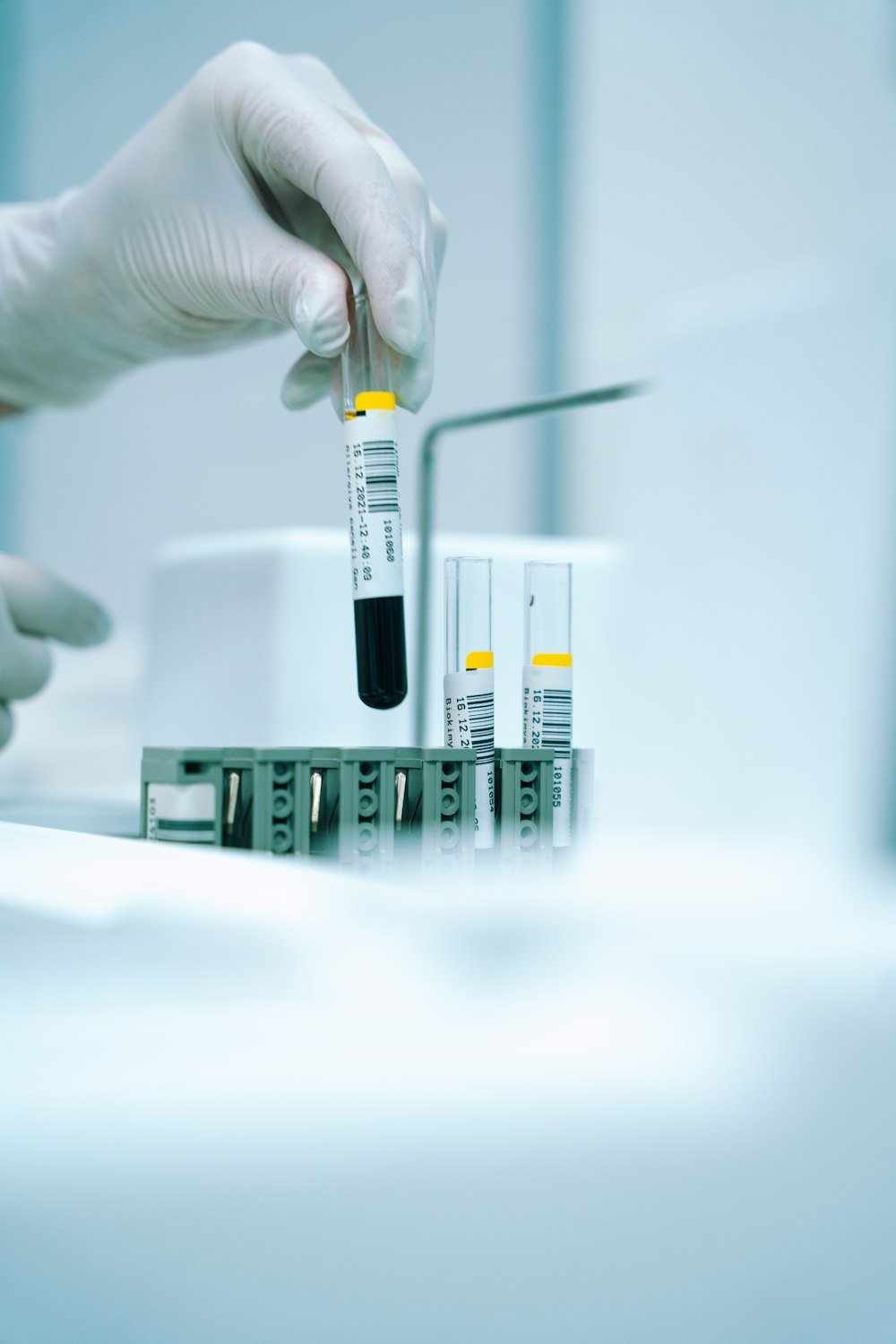 Amostras de exames laboratoriais